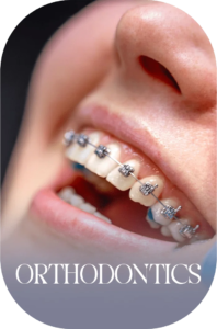 imageye___-_imgi_59_Orthodontics-1