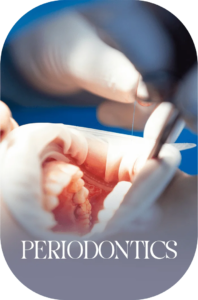 imageye___-_imgi_60_Periodontics-1