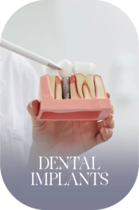 imageye___-_imgi_64_Dental-Implants-1